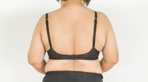 How to Get Rid of Back Fat for Good